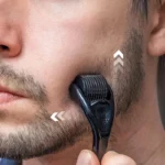 0.2-0.3mm Microneedle for Facial Body Hair Growth Derma Roller for Skin Beard 540 Needles Micro Face Roll Tool - Image 3