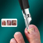 Thick Ingrown Nails Heavy Duty Stainless Steel Trimmer Safety Soft Grip Ultra Sharp 25 Degree Angled Blade Seniors Splash Proof
